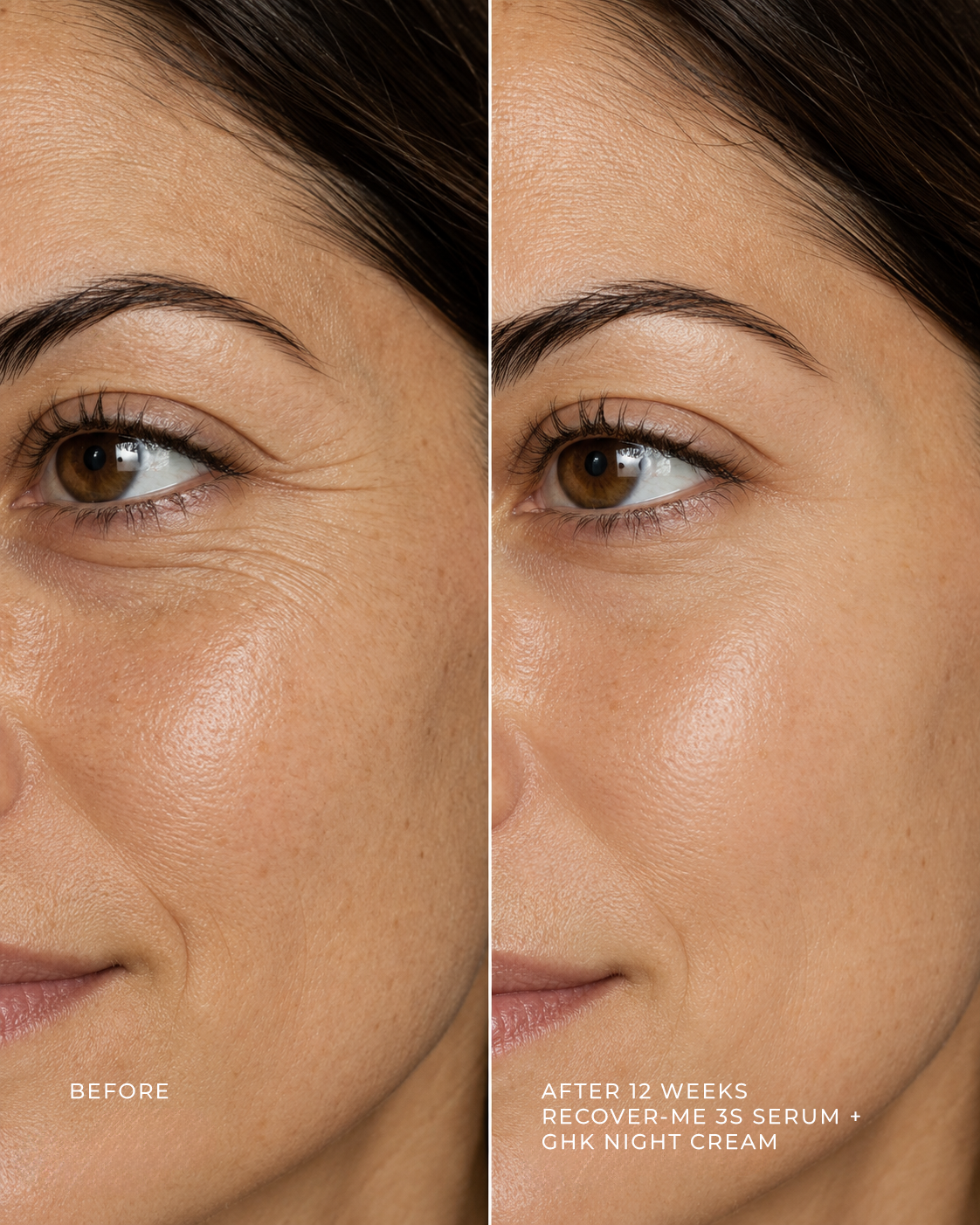Recover-Me Serum biotechnology treatment