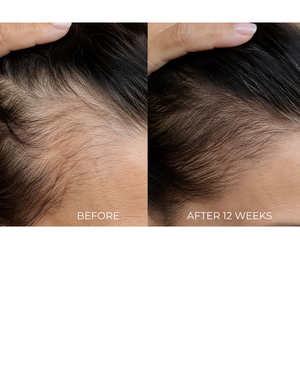 AHK PEPTIDE HAIR & SCALP SERUM