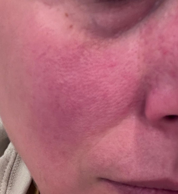 Jen Valenti's skin before The Ritual