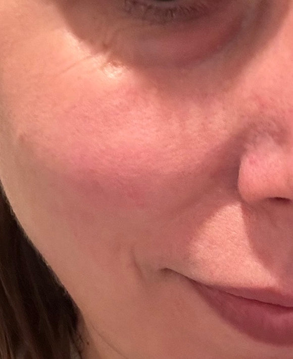 Jen Valenti's skin after establishing The Ritual
